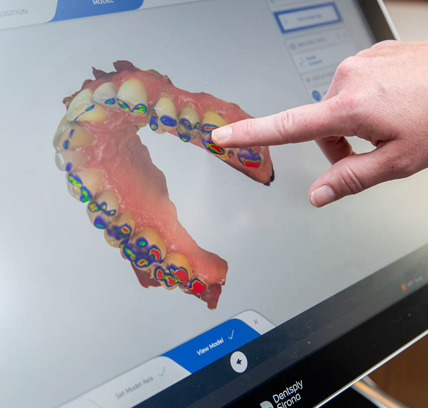 Boost Your Oral Health With Our Dental Technology in St. Louis